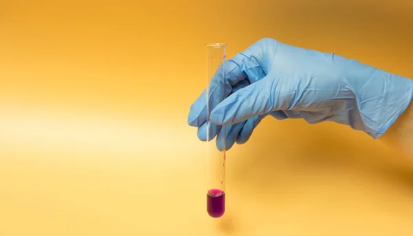 Mavi eldivenli bir el Coronavirus COVID-19 'un test tüpünü tutuyor. Sarı arkaplanda kavram