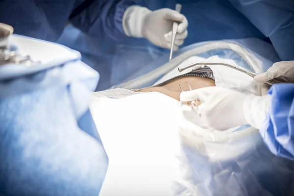 Médecins avec des outils dans les mains faisant la chirurgie dans la salle d'opération. Soins de santé et concept hospitalier — Photo