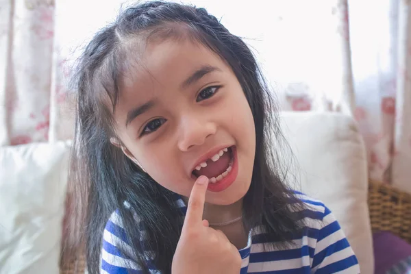 Ásia Menina Mostrando Fora Ela Falta Frente Dente — Fotografia de Stock