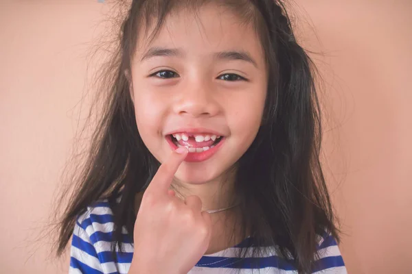 Ásia Menina Mostrando Fora Ela Falta Frente Dente — Fotografia de Stock