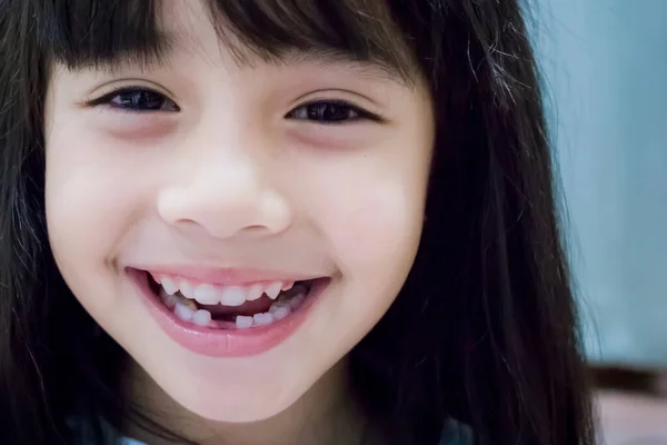 Χαριτωμένο Κοριτσάκι Δείχνει Σπασμένα Δόντια Γάλα Της — Φωτογραφία Αρχείου