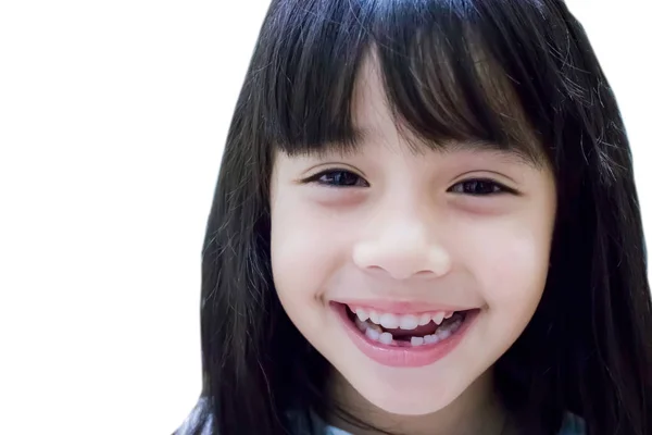 Μικρό Κορίτσι Δείχνει Σπασμένα Δόντια Γάλα Της Απομονώνονται Λευκό Φόντο — Φωτογραφία Αρχείου