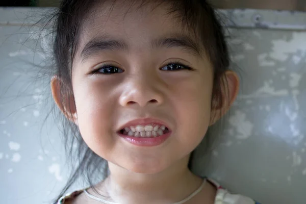 Menina Com Boca Aberta Mostrando Dentes — Fotografia de Stock