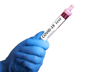 Elinde mavi eldivenle Coronavirus 'un (Covid-19) kan testi. Coronavirus Covid. Beyaz arka planda biyolojik tehlike korumasında 19 kan örneği.