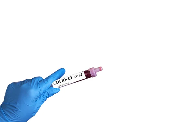 青手袋を手にコロナウイルス Covid のサンプル血液検査 コロナウイルスCovid 19血液サンプル白地のサンプルバイオハザード保護 — ストック写真