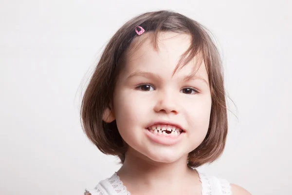 Dziecko odrzucone pierwsze zęby mleczne — Zdjęcie stockowe