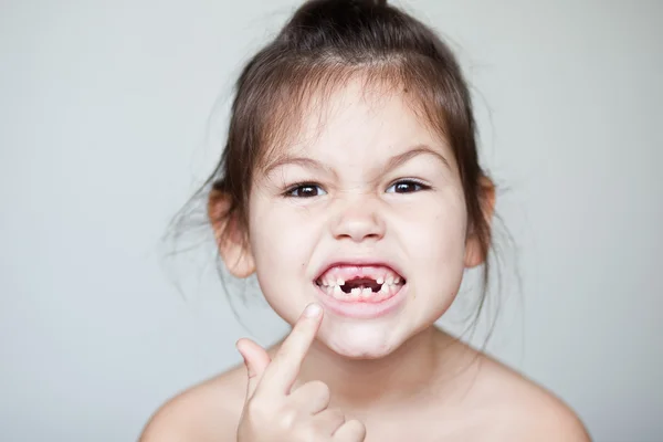 Menina mostrando seus dentes de leite desaparecidos — Fotografia de Stock