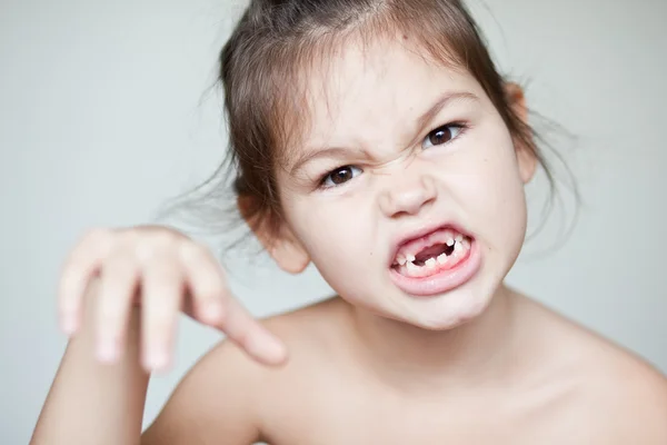 Girl showing off her missing milk teeth — Stock Photo, Image