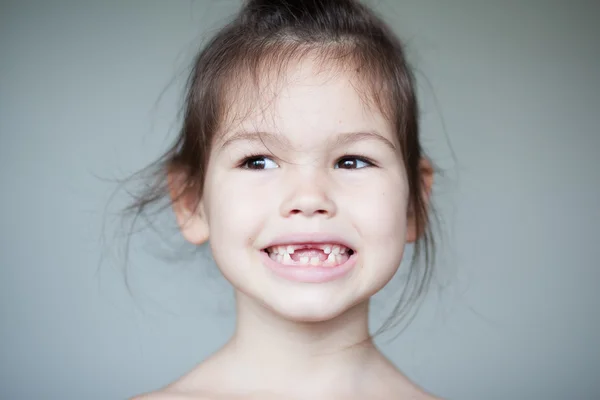 Meisje pronken haar ontbrekende tanden van de melk — Stockfoto