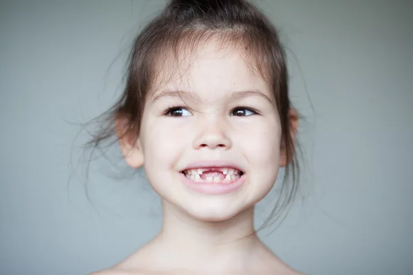 Dívka předvádí její chybějící mléčné zuby — Stock fotografie