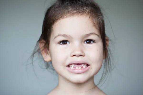 Ragazza mostrando i suoi denti da latte mancanti — Foto Stock