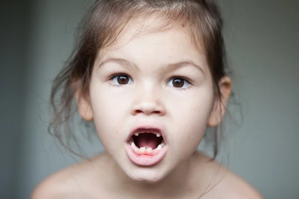 Girl showing off her missing milk teeth — Stock Photo, Image