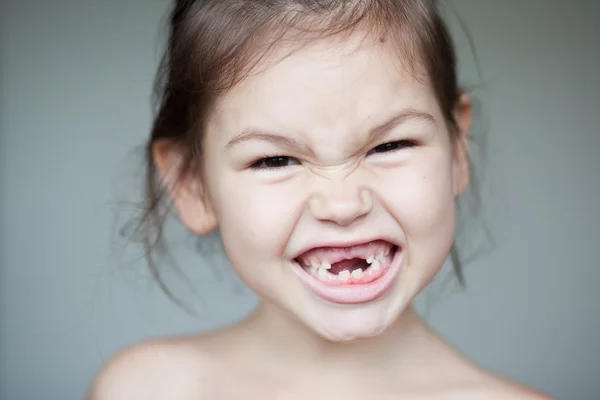 Дівчина показує свої відсутні молочні зуби — стокове фото