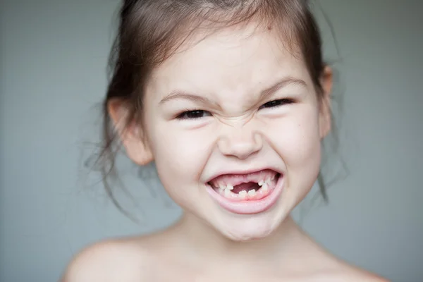 Chica mostrando su falta de dientes de leche — Foto de Stock