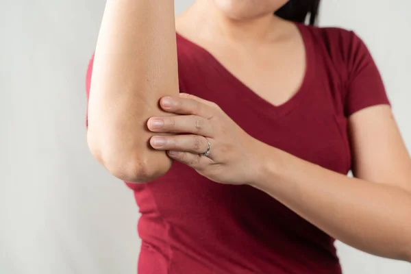 肘部疼痛 年轻女性受伤 医疗保健和医疗观念 — 图库照片