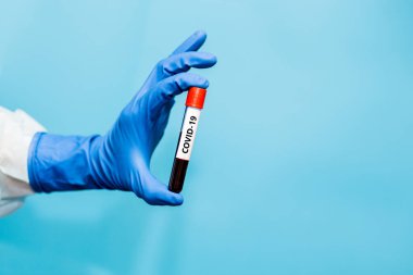Mavi eldivenli doktor mavi arkaplanda koronavirüs için test edilmiş kan örneği içeren test tüpü tutuyor. Coronavirus COVID 19 için hastaların kanını test ediyoruz..