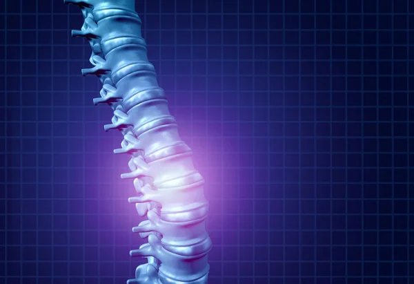 Back Spine Pain — Stock Photo, Image