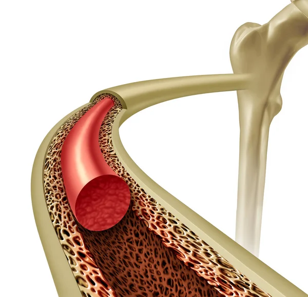 Conceito de medula óssea — Fotografia de Stock