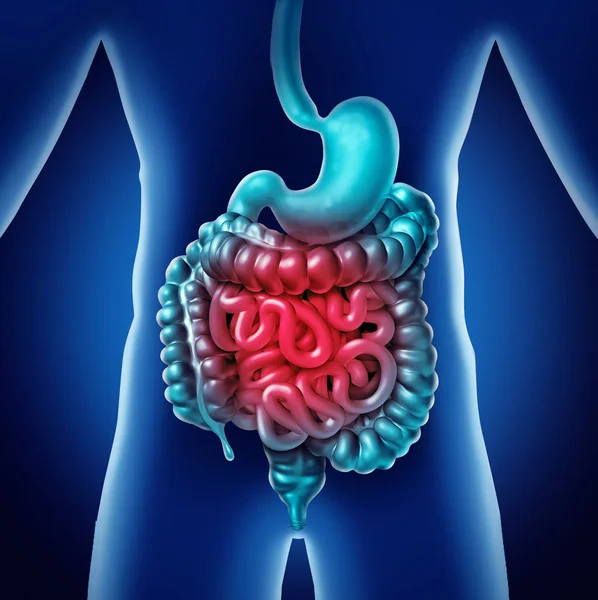 Dolor intestinal Concepto médico — Foto de Stock