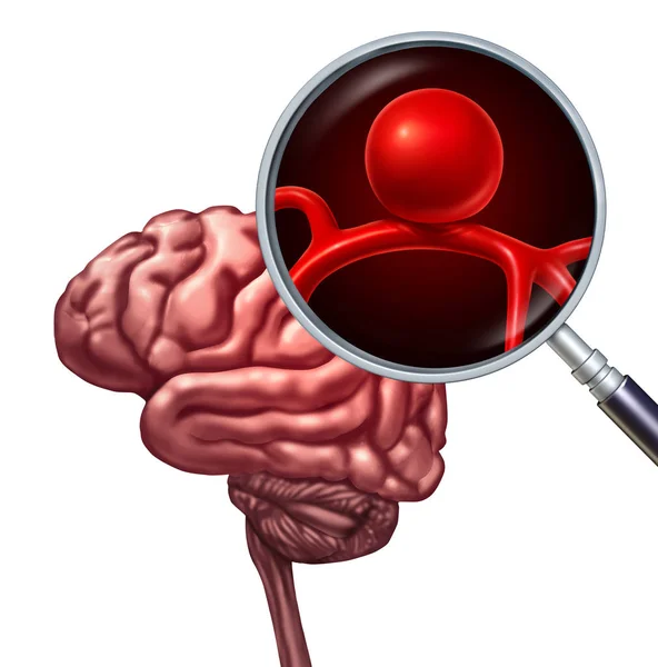 Symbol tętniaka mózgu — Zdjęcie stockowe