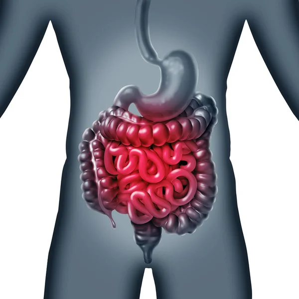 Concetto di dolore intestinale — Foto Stock