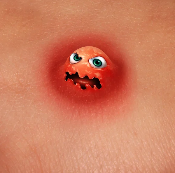 Pimple Monster — Stock Photo, Image