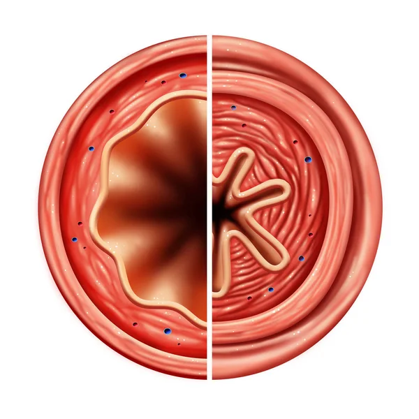 Astma bronchiale buis — Stockfoto