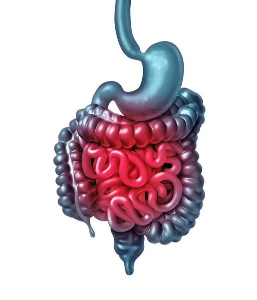 Intestino doloroso —  Fotos de Stock