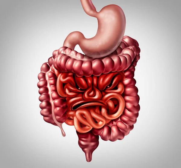 Síndrome del intestino irritable — Foto de Stock