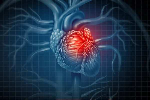 Attacco cardiaco — Foto Stock