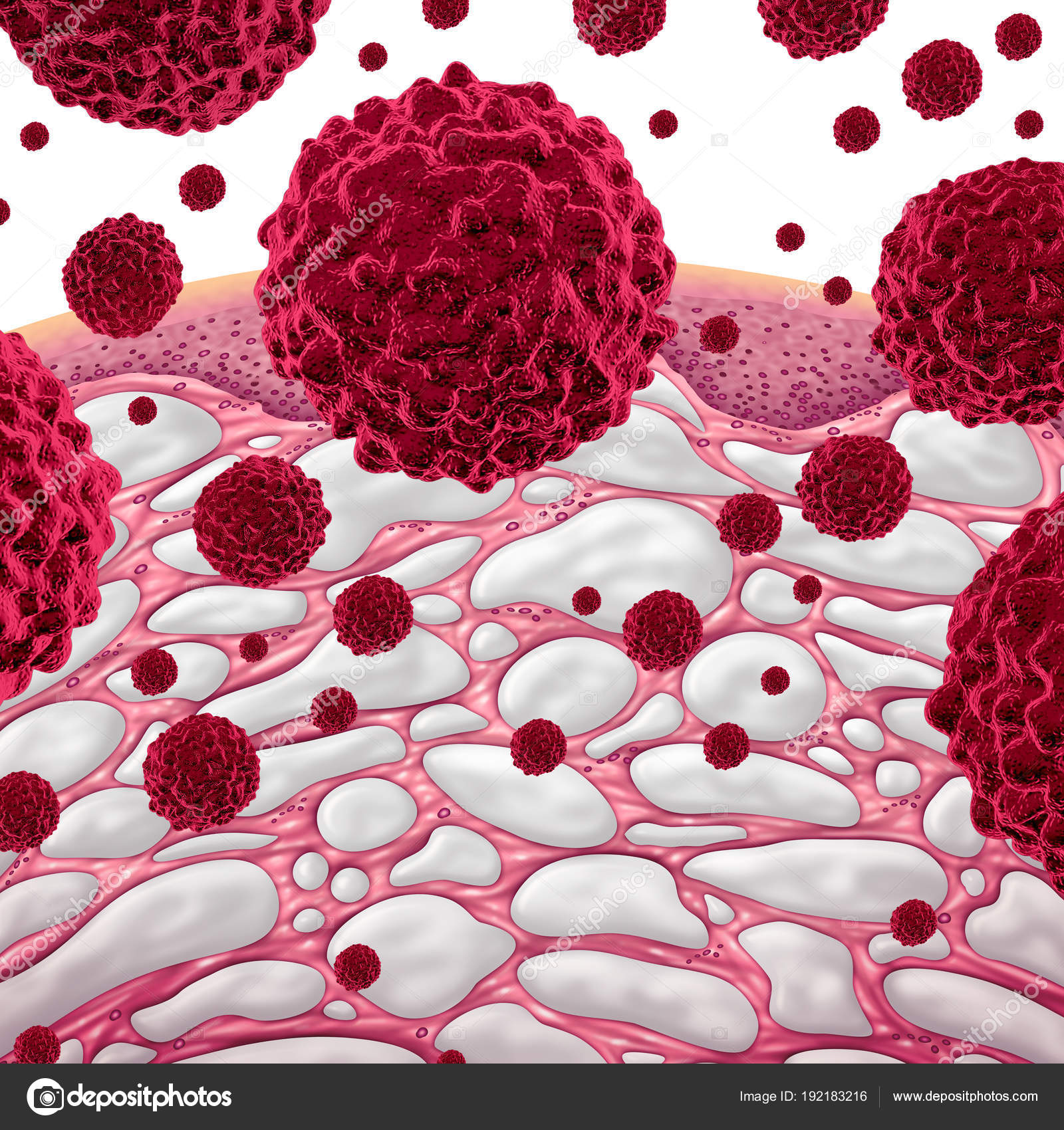 间质和癌症——图库图片© lightsource #192183216, image size:1600x1700