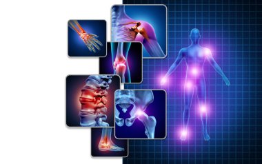 Joint body pain concept as skeleton and muscle anatomy of the body with a group of sore joints as a painful injury or arthritis illness symbol for health care and medical symptoms with 3D illustration elements. clipart