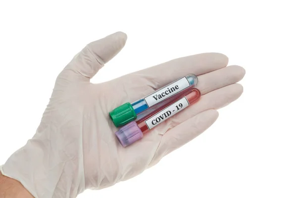 Laboratorní zkumavky na koronavirus a alergii v ruce s rukavicemi. — Stock fotografie