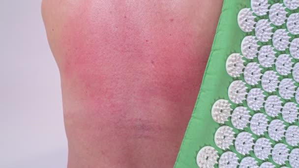 Eine Frau mittleren Alters schlägt ihren roten Rücken von einer Massage gegen Schmerzen in Rücken und Wirbelsäule auf einem Akupunkturteppich. Nahaufnahme. — Stockvideo