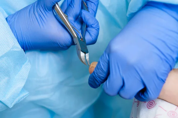 A pedicure master treats a patients ingrown nail with pedicure nippers in blue gloves against a blue robe