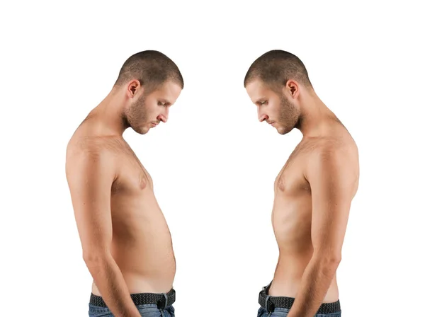 Skinny Or Fat Concept — Stock Photo, Image