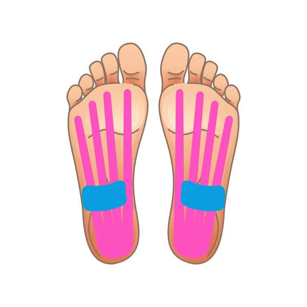 Hur man använder kinesiologi tejp på fötterna — Stock vektor