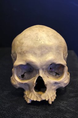 Yıpranmış bir insan kafatası