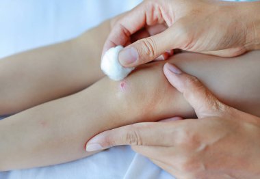 Çocuk diz yaraya kapatın. Soyunma çocuğun diz anne.