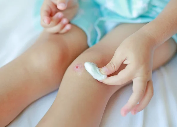 Close Up of child girl dressing wound on knee by self on the bed. — Stok Foto