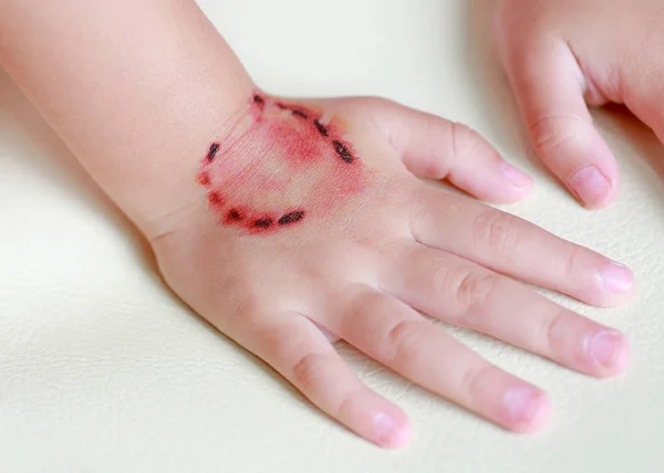 Aufkleber Wunde und Blut von einem Biss menschliche Zähne auf Kinderhand, verkleiden Tätowierungen, Halloween-Konzept. — Stockfoto