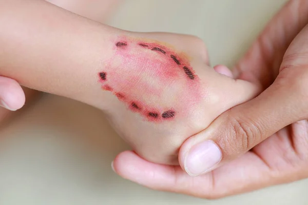 Наклейка рана і кров від укусу людських зубів на дочірній руці, Одягаються татуювання, концепція Хеллоуїна . — стокове фото