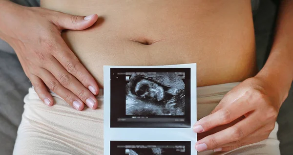 Mulher grávida mostrar filme de ultra-som — Fotografia de Stock