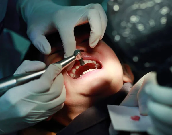 Menina durante a extração dentária — Fotografia de Stock