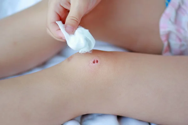 Close Up de criança menina vestir ferida no joelho por si mesmo na cama . — Fotografia de Stock