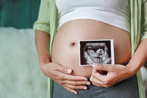 Gravid Kvinna Visa Ultraljud Film Stående House — Stockfoto