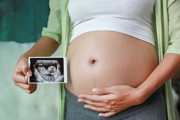 Έγκυος Γυναίκα Υπερηχογραφική Εμφάνιση Ταινία Ενώ Στέκεται Στο Σπίτι — Φωτογραφία Αρχείου