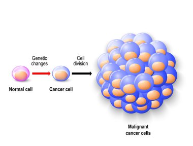 Normal human cell, cancer cell and malignant cancer clipart
