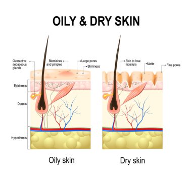 Oily & dry skin. Human Skin types and conditions.  clipart