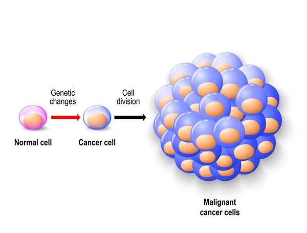 Normál emberi sejt, a rákos sejt és a rosszindulatú rákos — Stock Vector